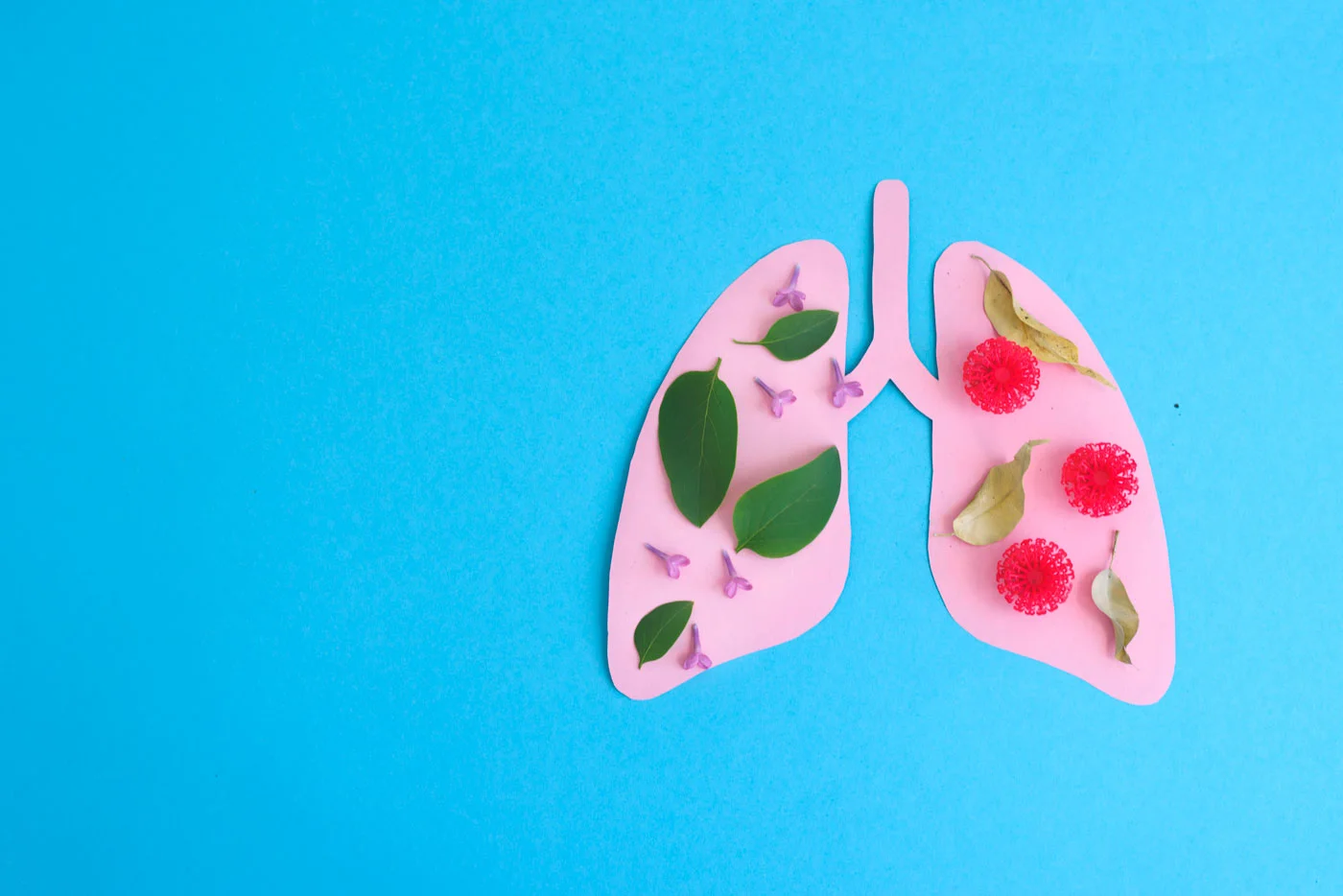 adenocarcinoma pulmonar - Dr Rodrigo Riera Sala - Oncologo 1400x934