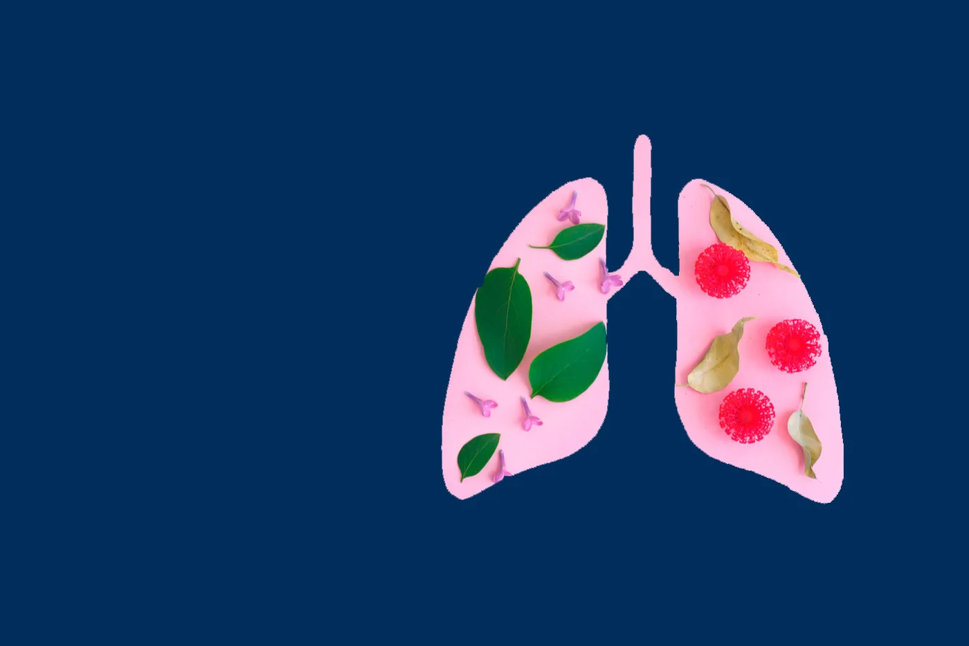 adenocarcinoma pulmonar - Dr Rodrigo Riera Sala - Oncologo 1400x934 -2